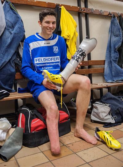 Martin Hofbauer, joueur de football et amputÃÂ© d'une jambe